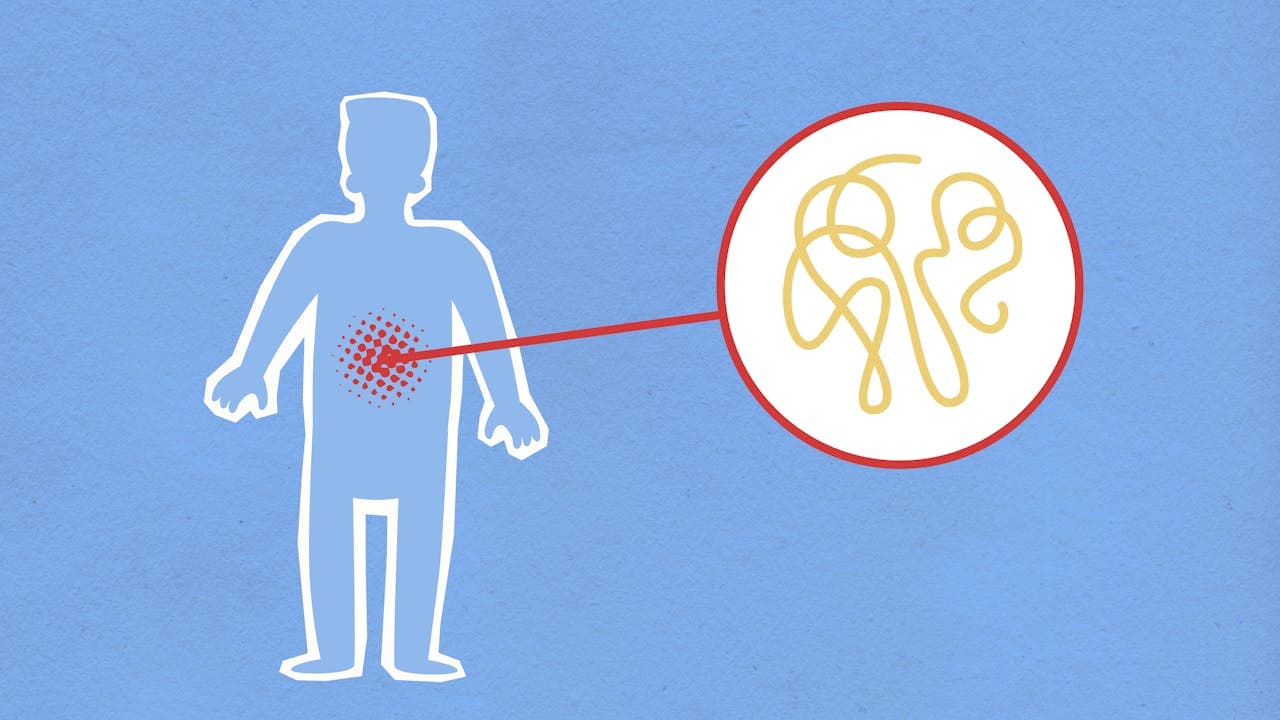 Inflammation modulation versus inflammation suppression in laser therapy